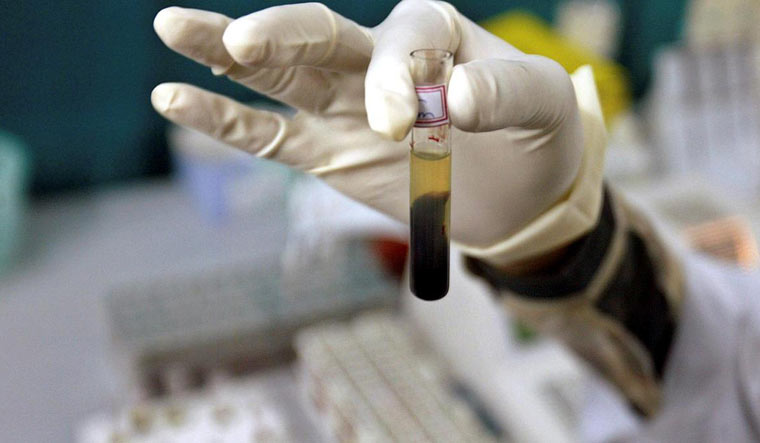 India accounts for second highest number of cases in hepatitis B & C after China: WHO