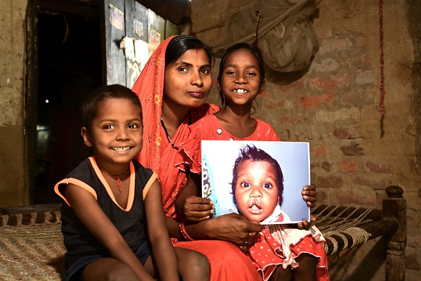 Smile Train India Marks 800,000 Free Cleft Surgeries Smile Train India Marks 800,000 Free Cleft Surgeries
