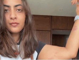 Aamir Khan’s niece shows injury marks after Mumbai detention in video